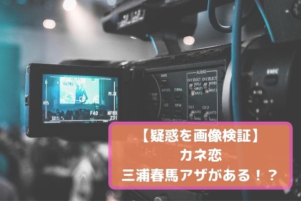 画像 カネ恋三浦春馬の右目下に青痣がある 顔以外にも痣があったのではないかという疑惑も みーよんらいふ